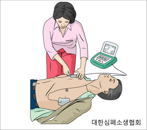 두 개의 패드 부착